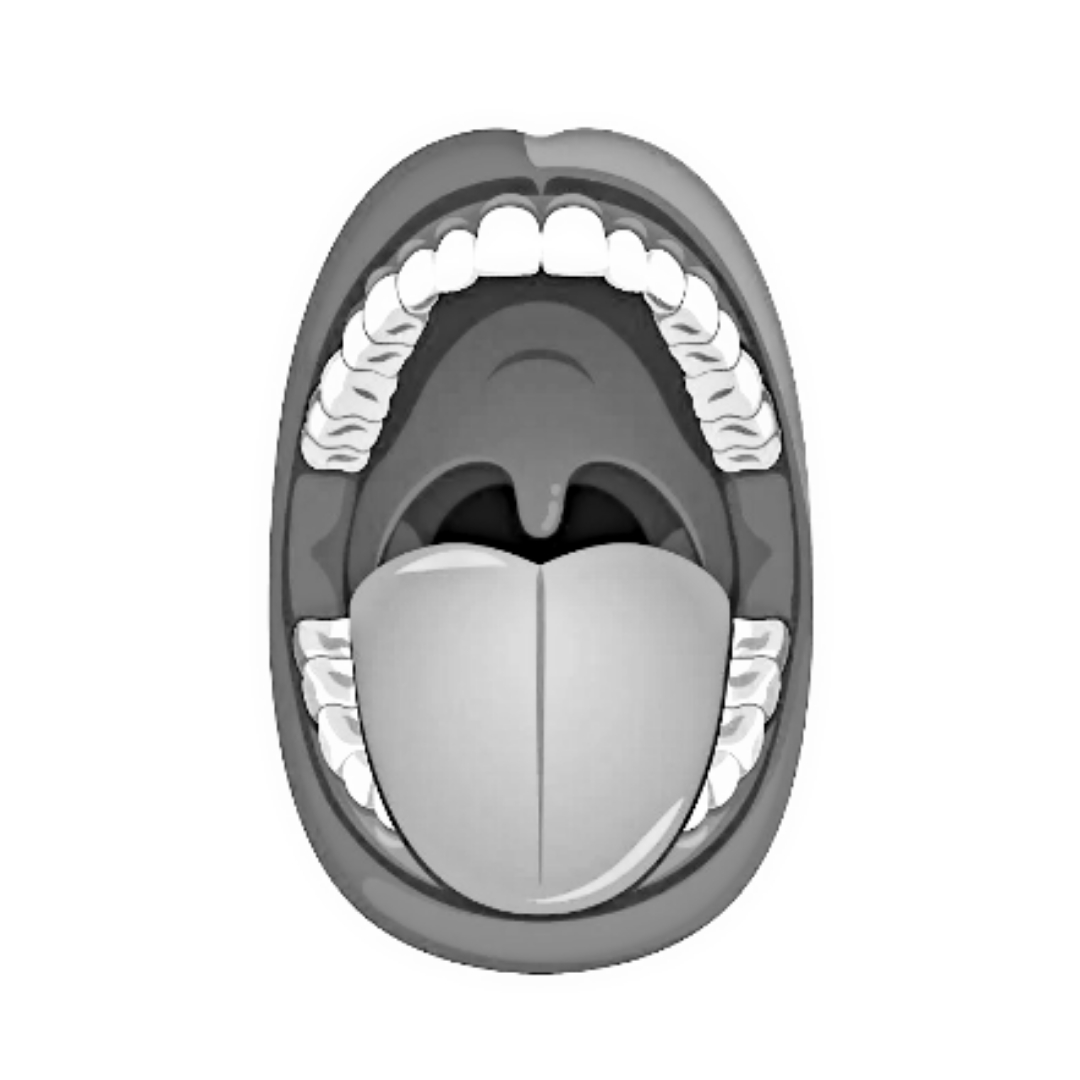 The Mallampati Classification | Anesthesia Blog