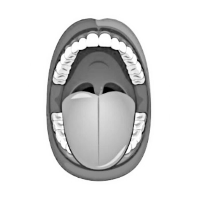 Mallampati Classification